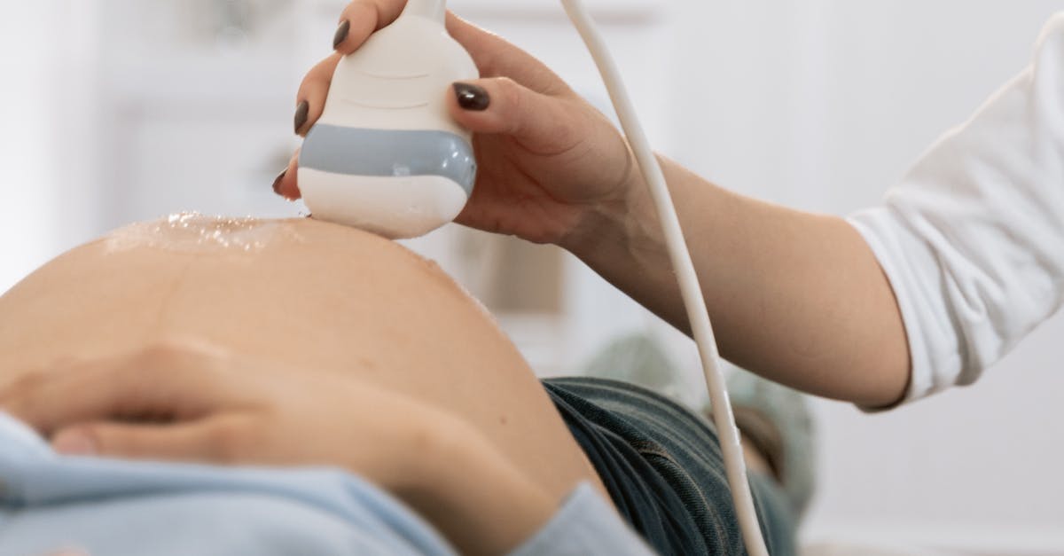 Why online reputation management matters?