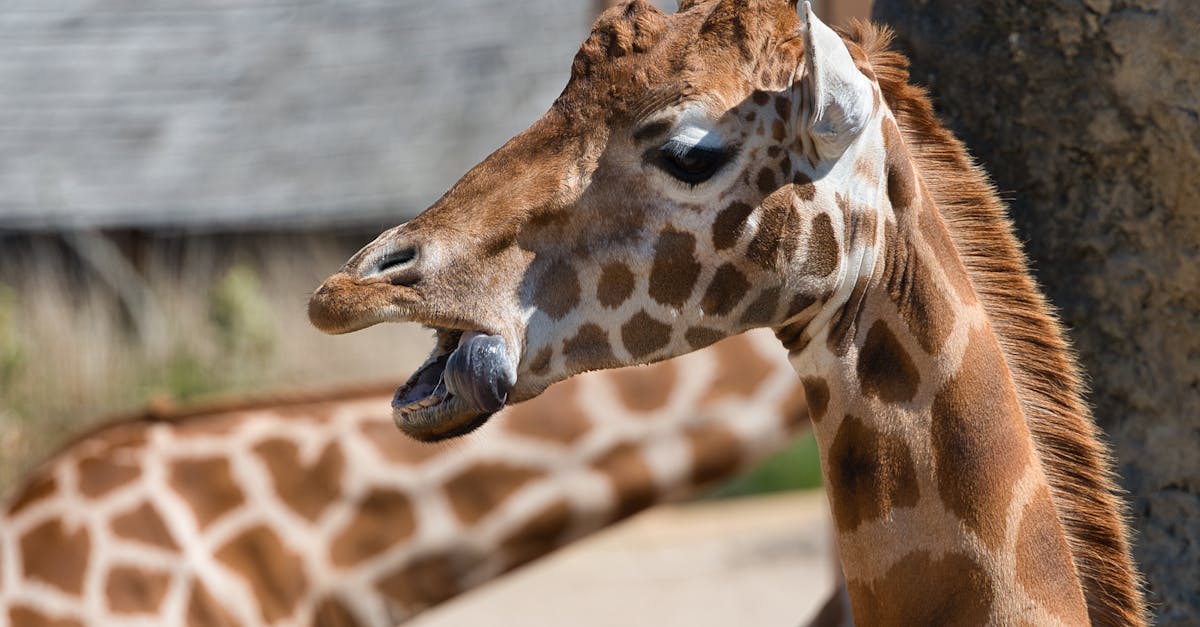 How long does a neck lift last?