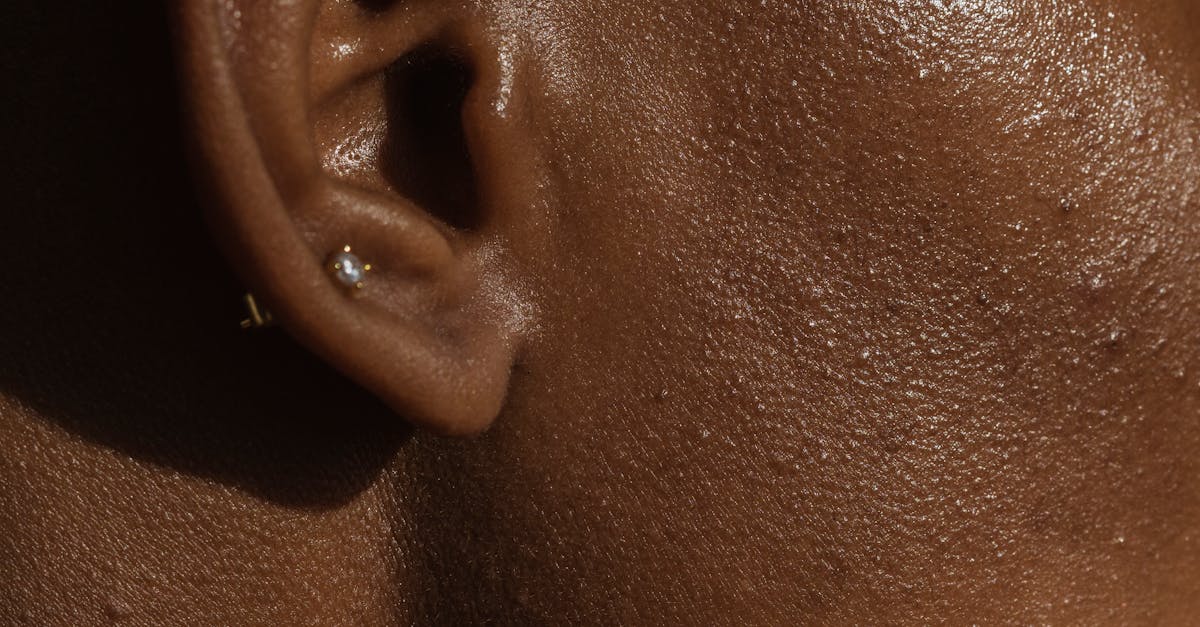 How long does ear surgery take to heal?