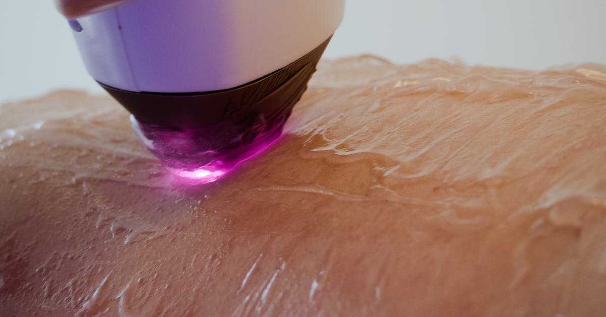 What are the pros and cons of laser hair removal?