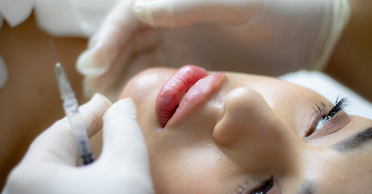 What is lip augmentation?