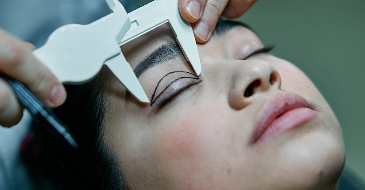 What is the recovery time for eyelid surgery?